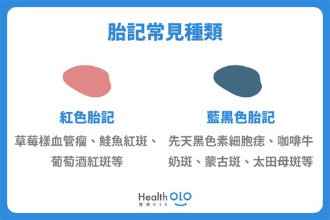 額頭有胎記|胎記怎麼產生、何時消除？醫師剖析胎記種類、胎記寓意